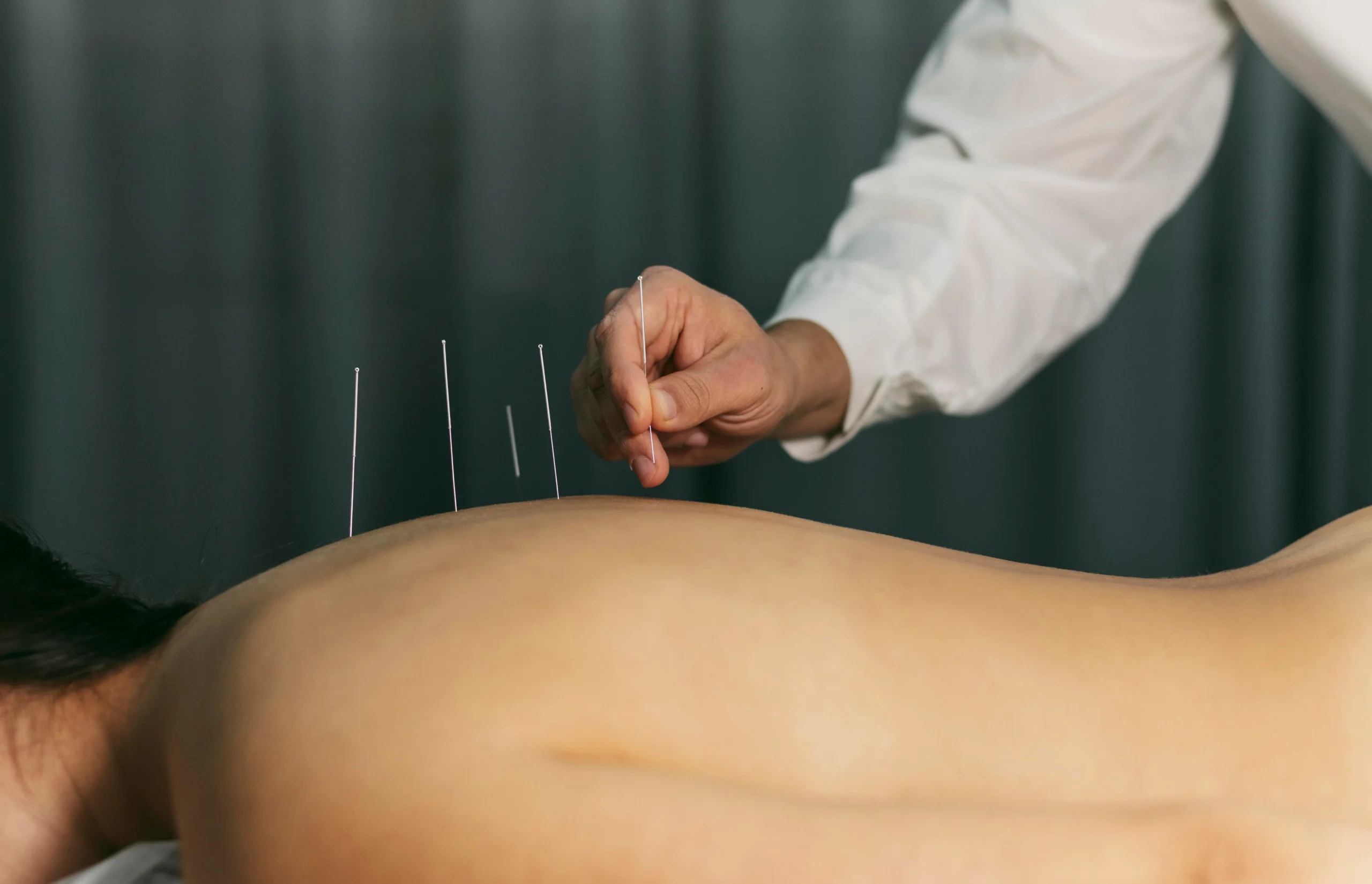 What Acupuncture Can Help You With | Full Treatment List