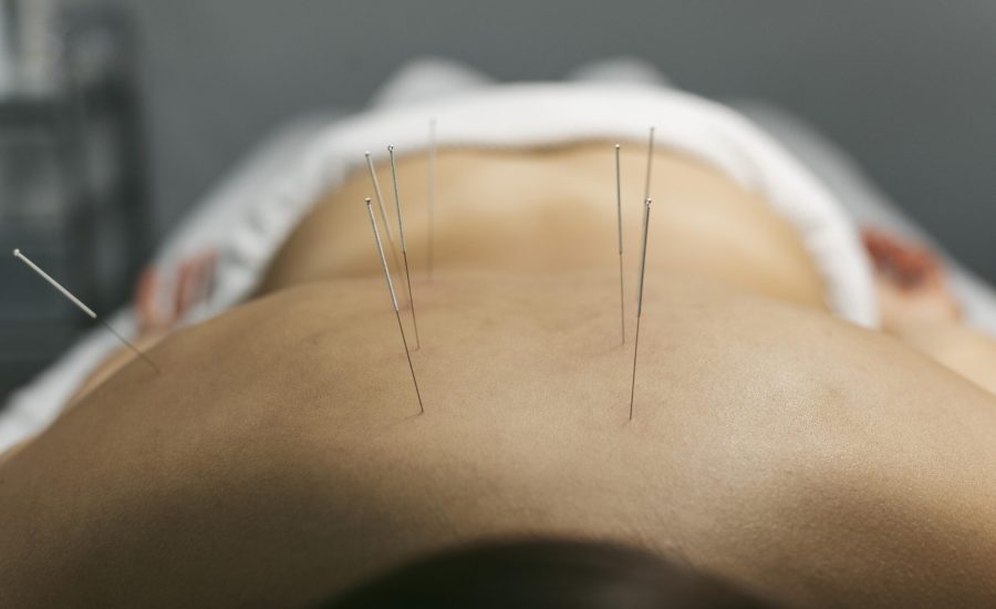 acupuncture-process-client